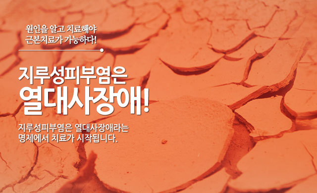 지루성피부염은열대사장애