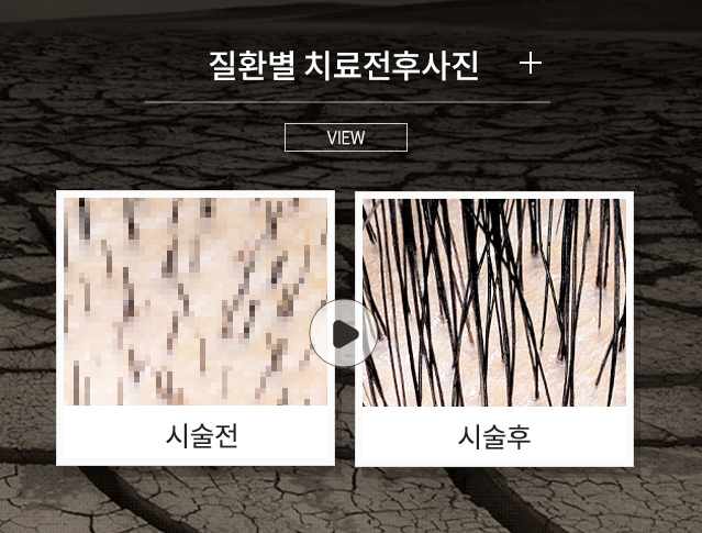 치료후기