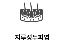 지루성두피염