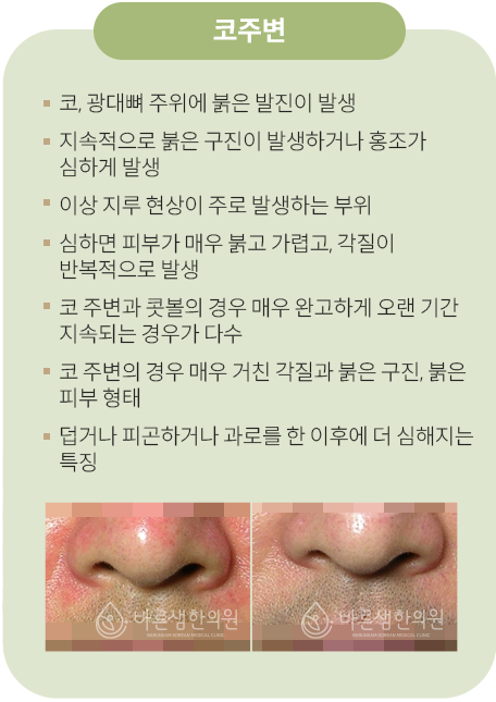 코주변