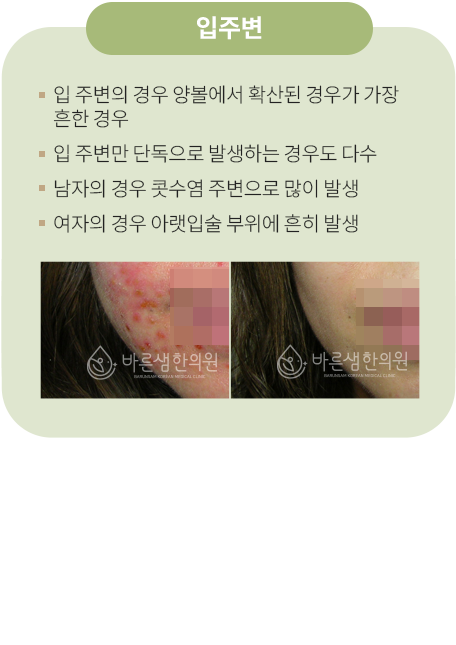 입주변