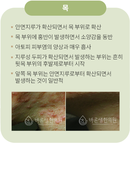 목
