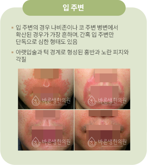 입주변