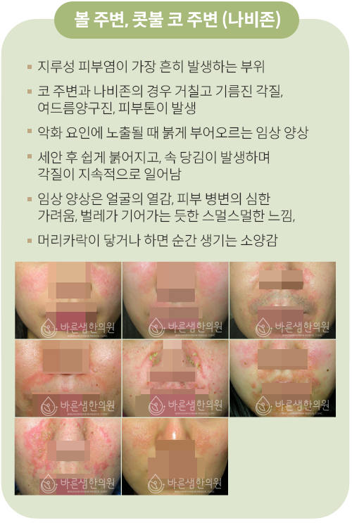 코주변