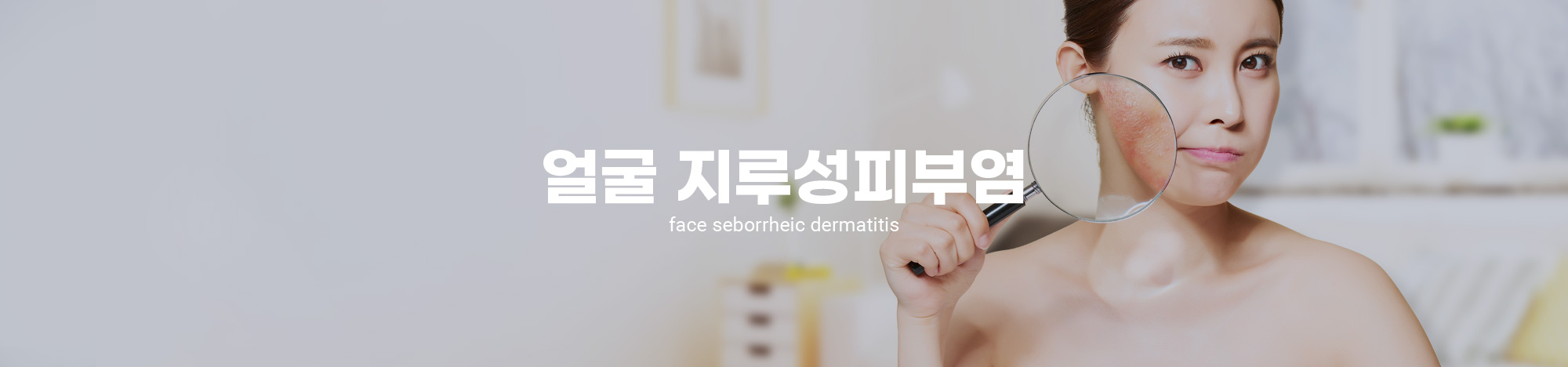 얼굴지루성피부염