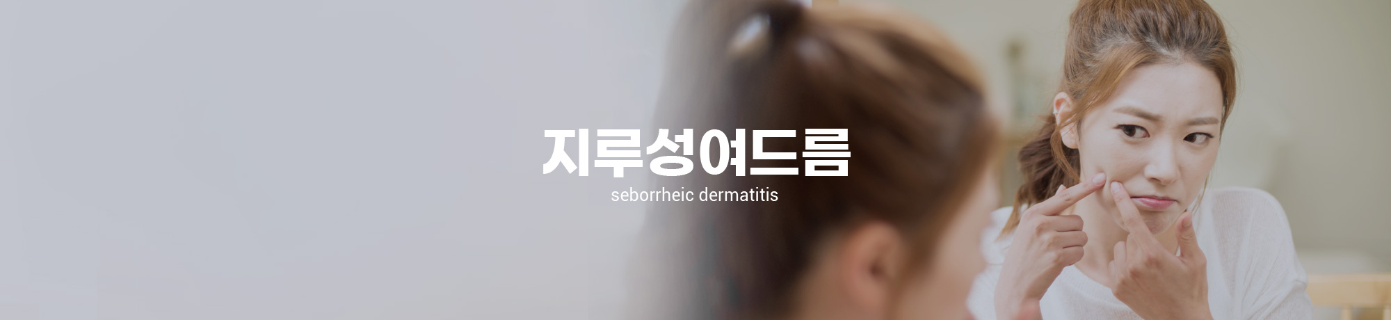 지루성피부염