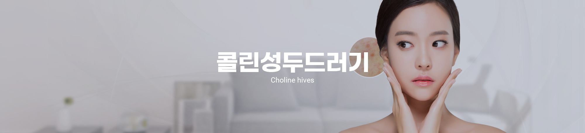 콜린성두드러기