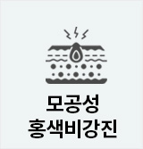 모공홍색비강진